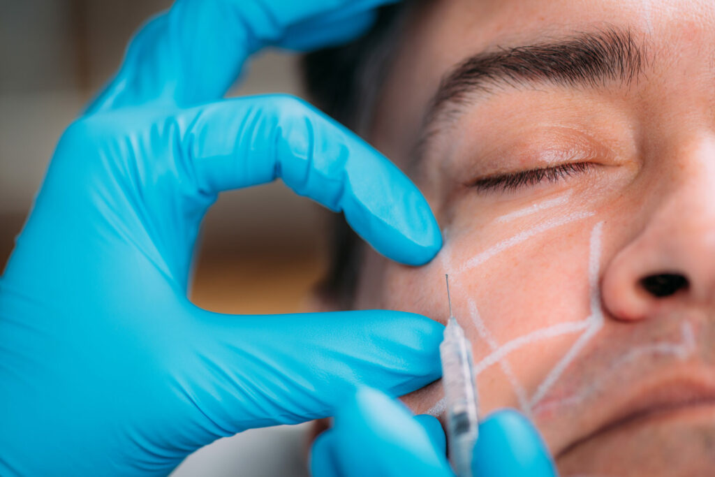 Dermal fillers | Monday Aesthetics | Burlington, WA