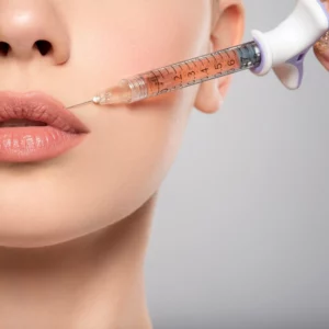 Face fillers | Monday Aesthetics | Burlington, WA