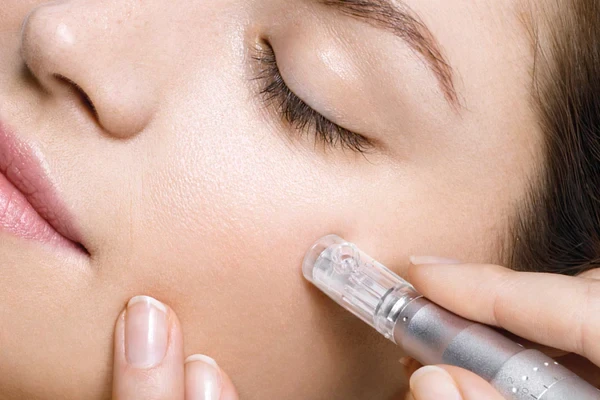 Microneedling | Monday Aesthetics | Burlington, WA